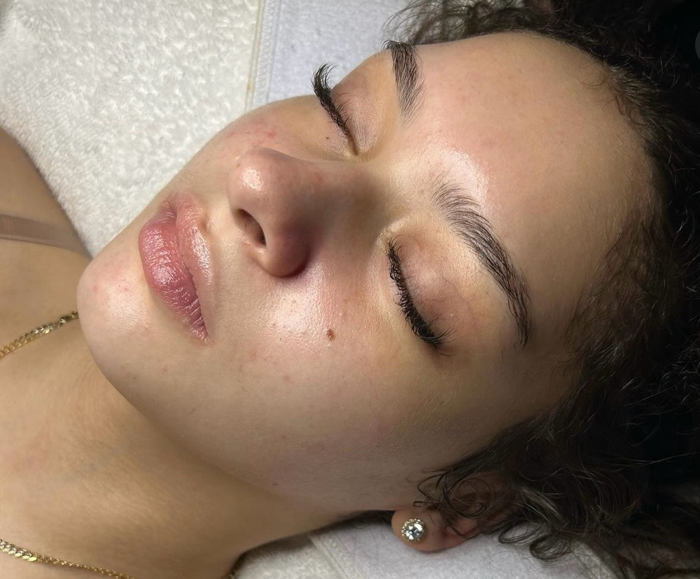 Teen Facial