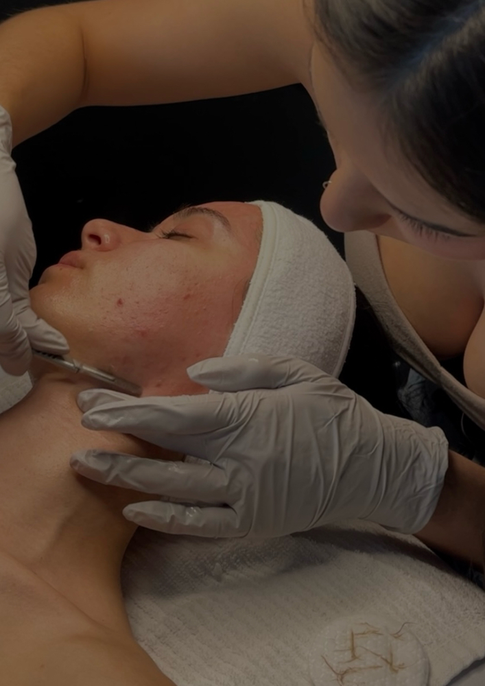 The Elegant Exfoliation Facial