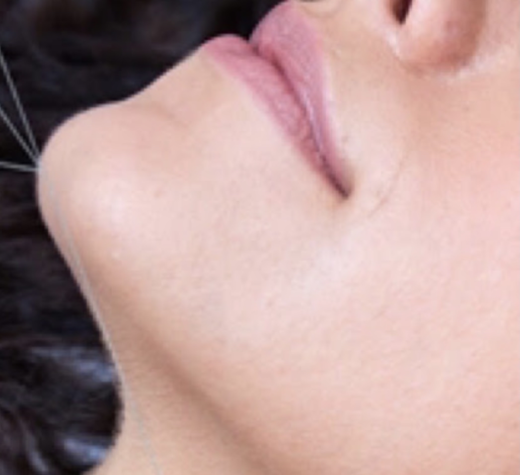 Chin