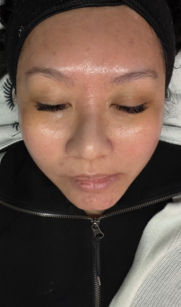 Korean Glass Skin Peel at Abtsolute Beauty in Sioux Falls, SD