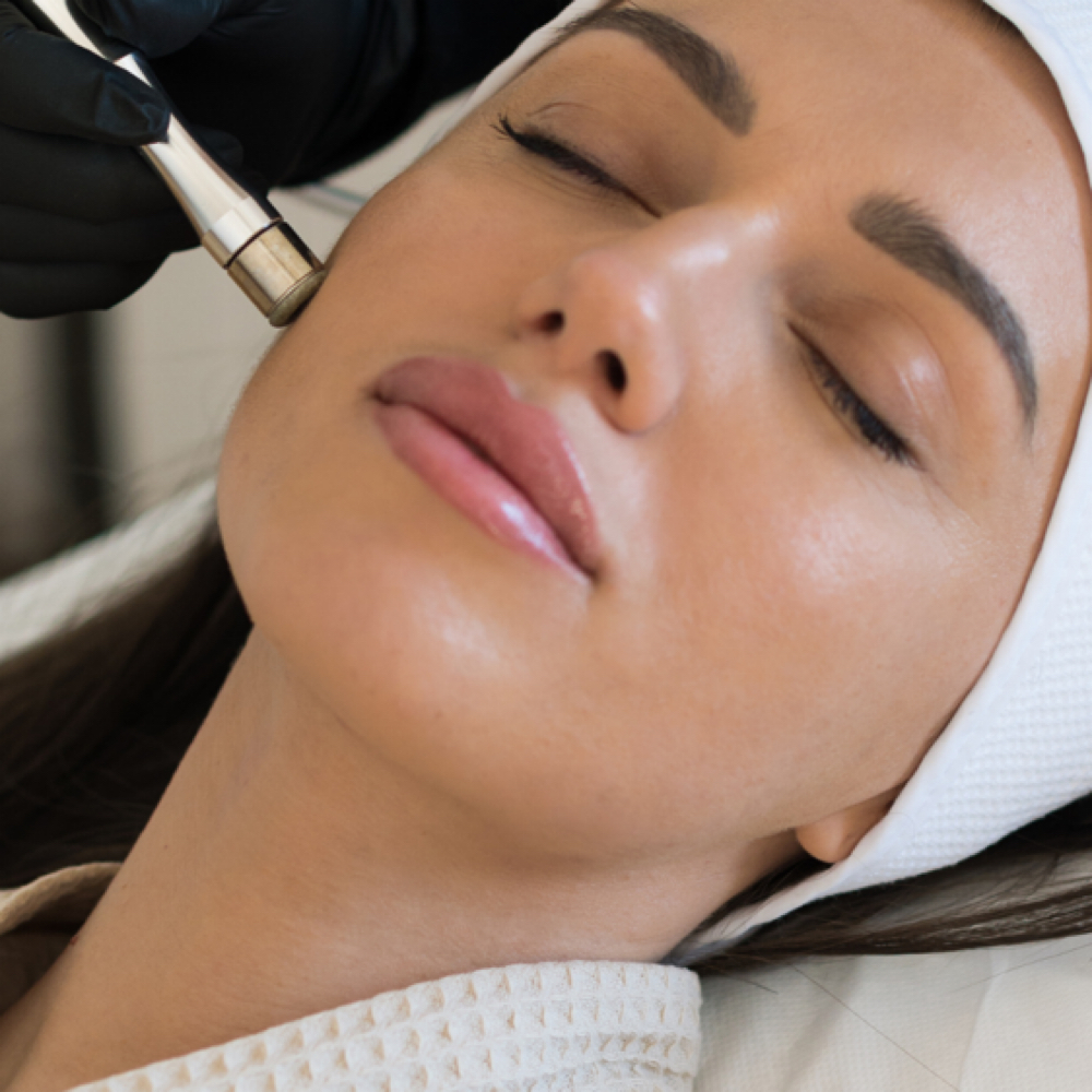 Microdermabration at Perma Glow Shanna in Elmhurst, NY
