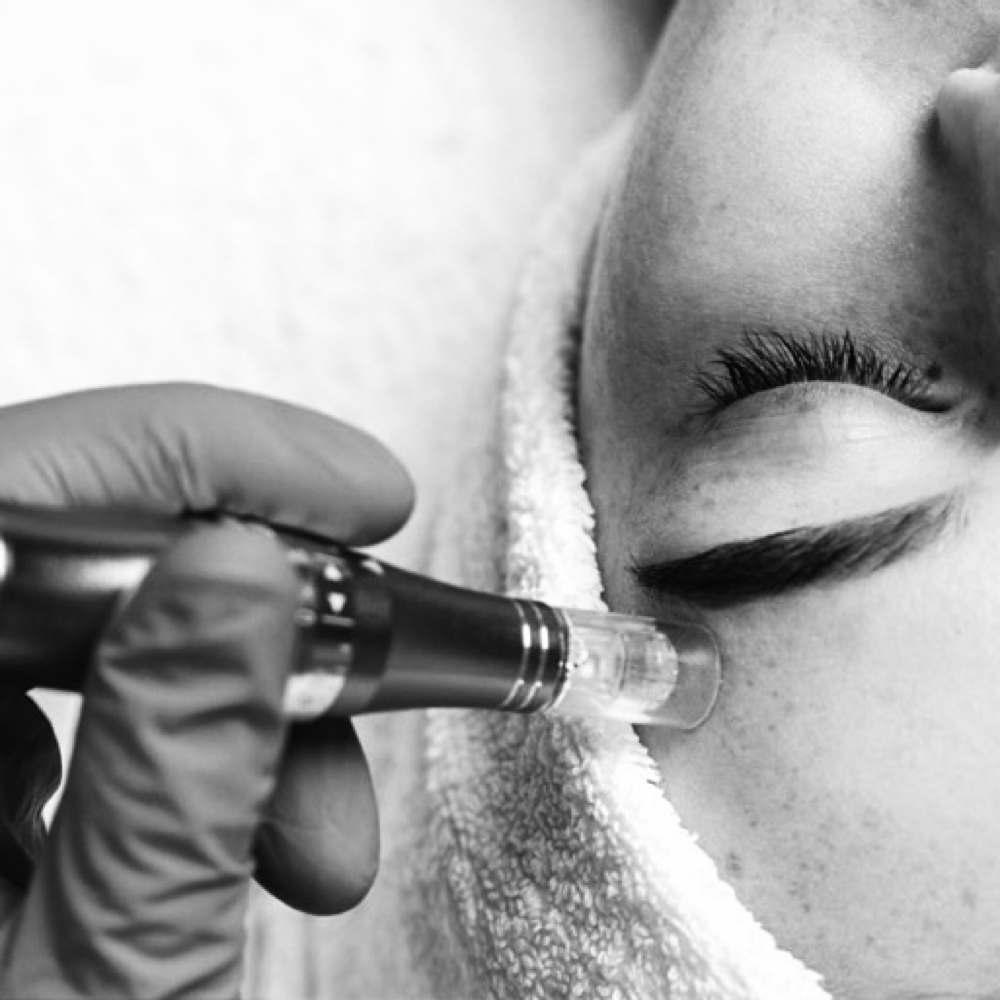 Microneedling Facial at RGV beauty studio in Edinburg, TX