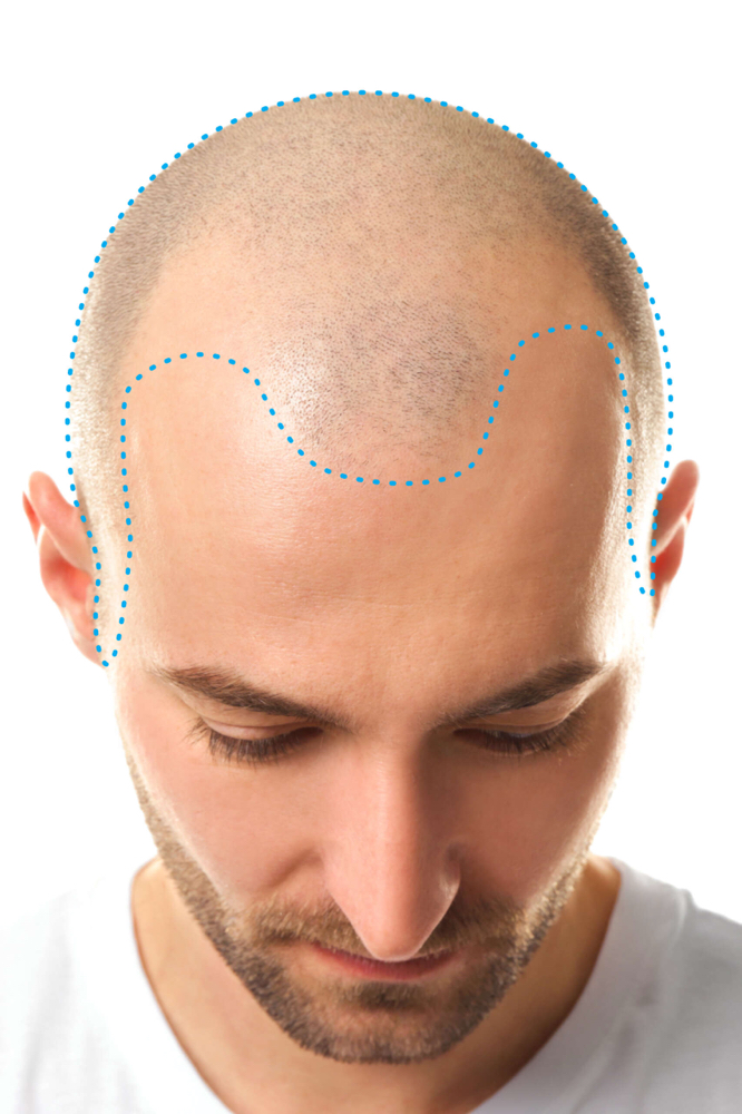 Head/Cabeza