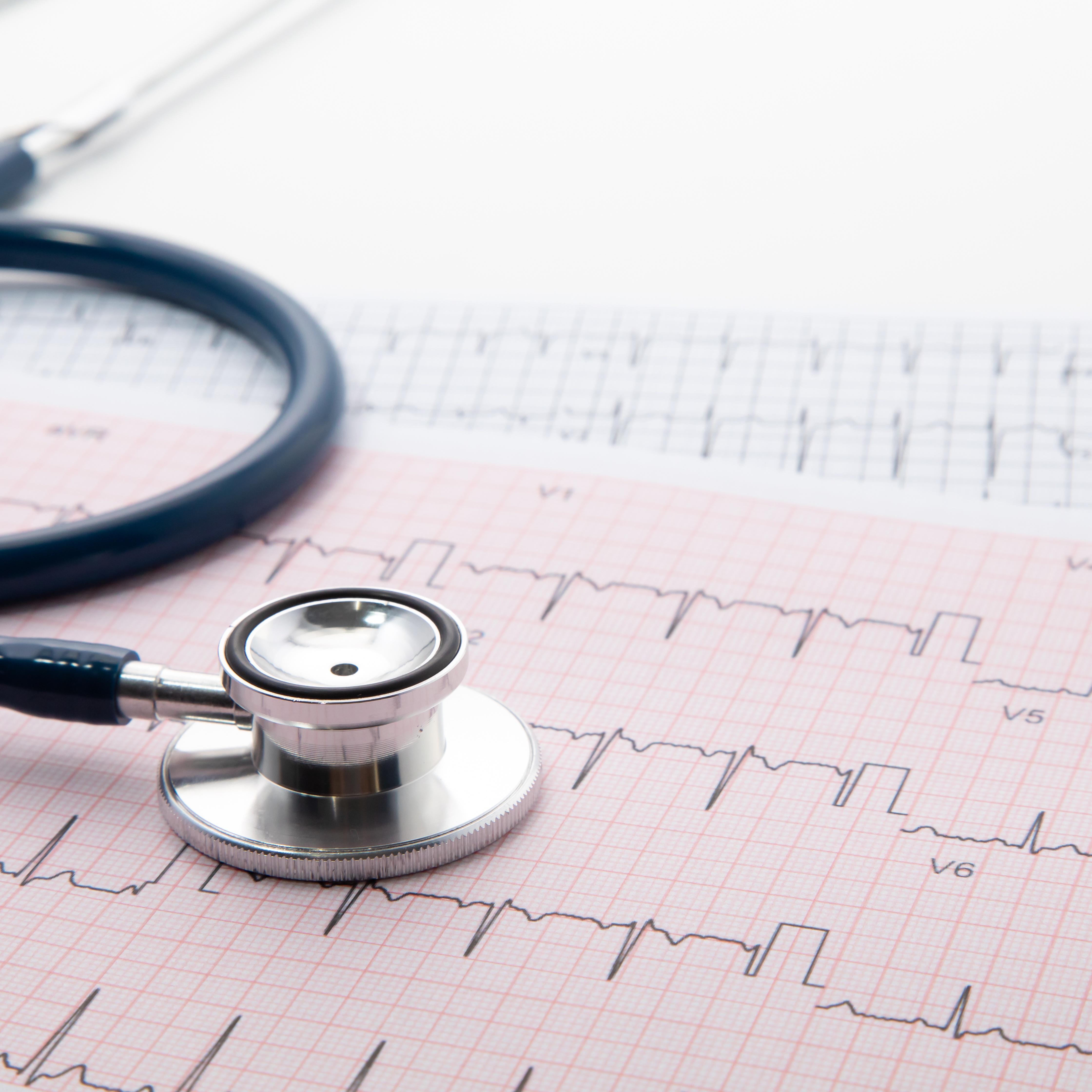 6 Lead EKG at Give-A-Little More Lab Services & more in HOUSTON, TX