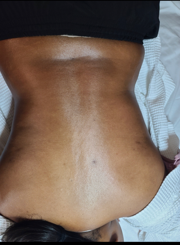 Back Facial