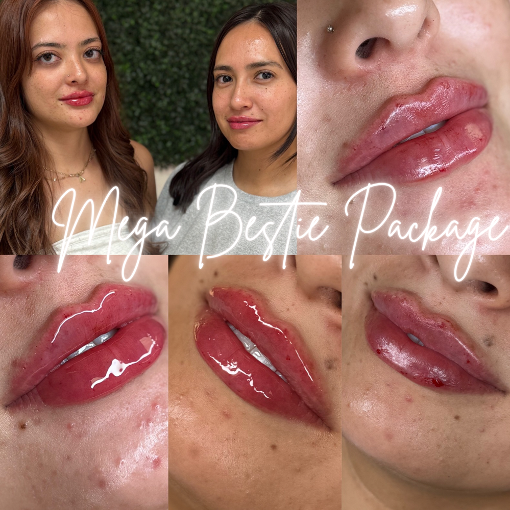 Mega Bestie Package👯‍♀️ at BeautyHolic Aesthetics LLC in Lubbock, TX