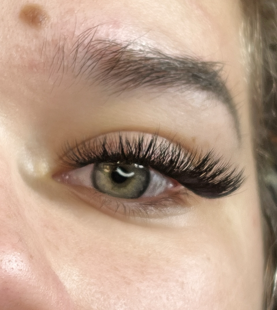 Volume Fill (2 Weeks)