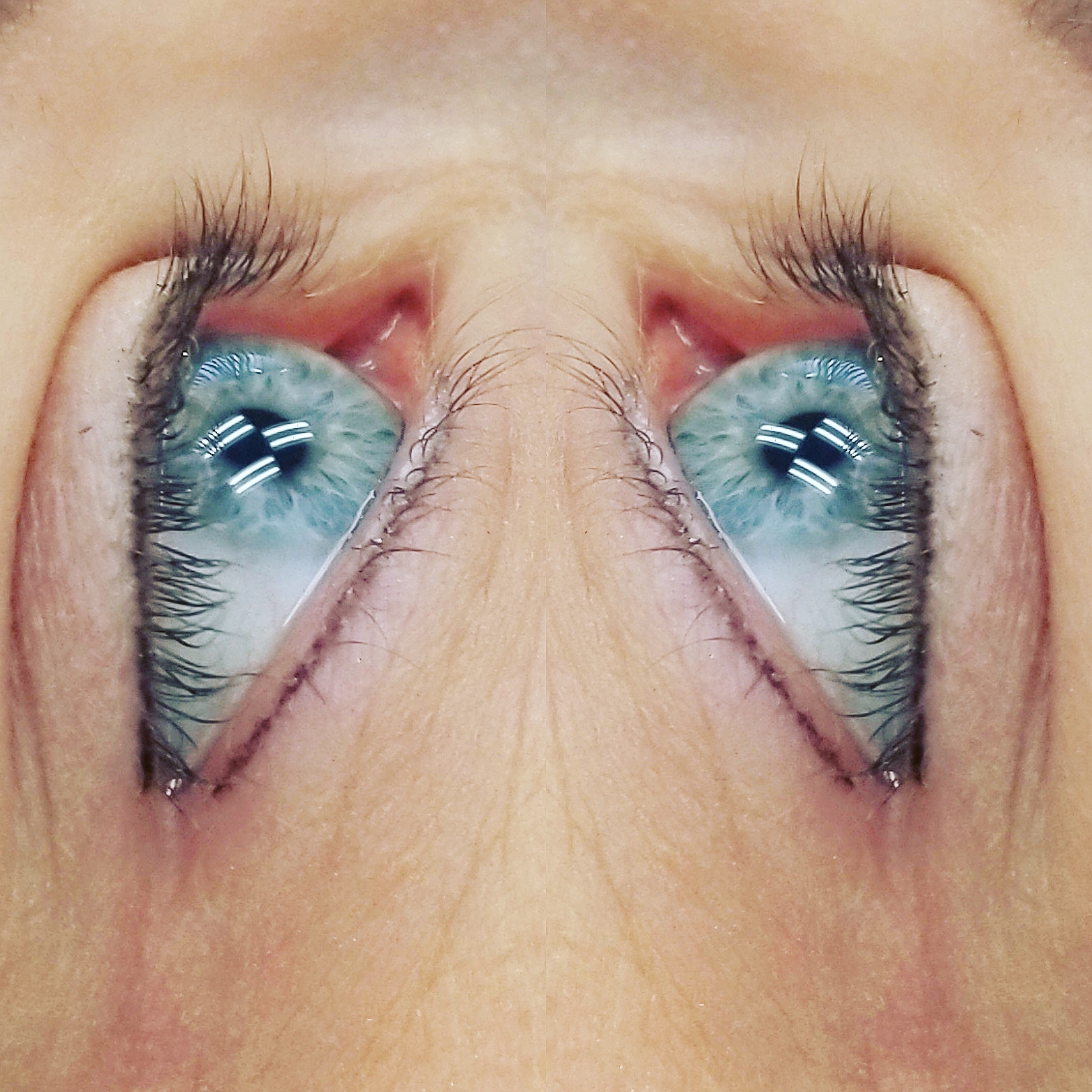 Eyelash Enhancement Top And Bottom