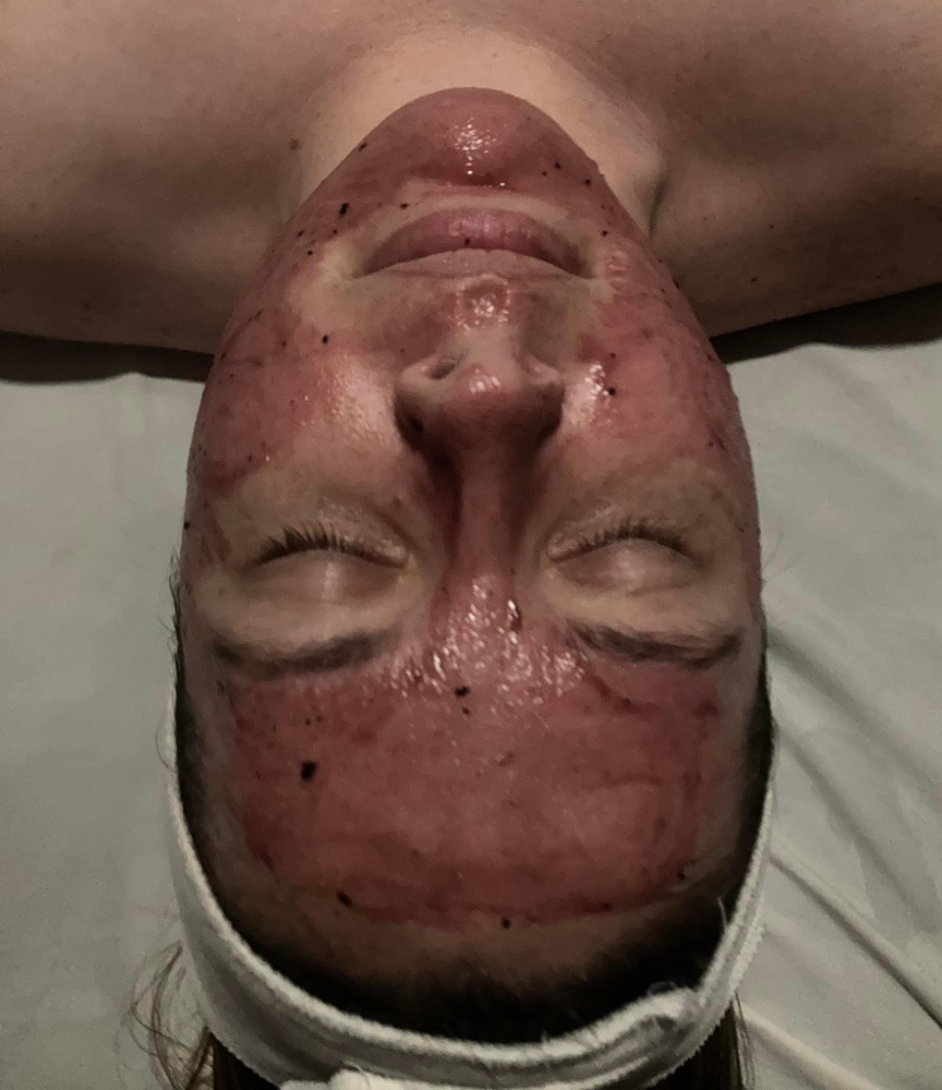 Express Facial