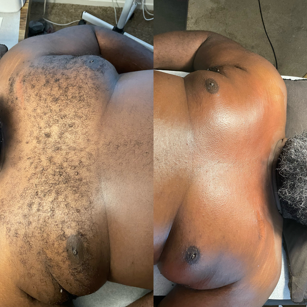 Chest Wax