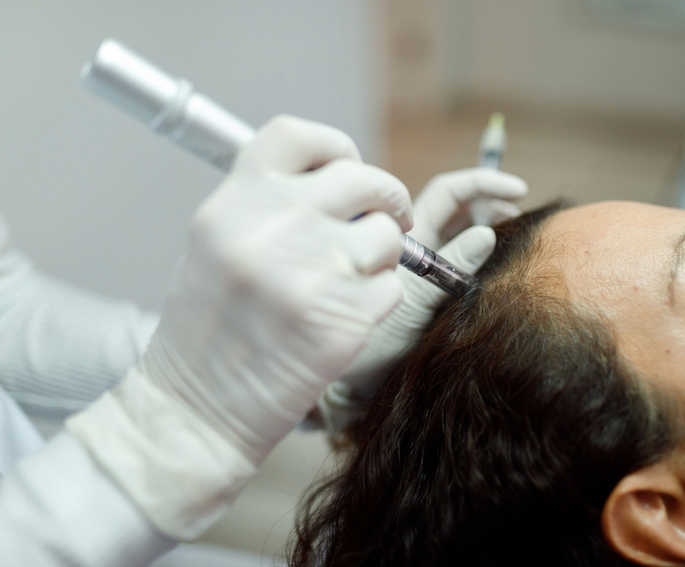 RevitaLux-HAIR LOSS at AesthetiX in Austin, TX