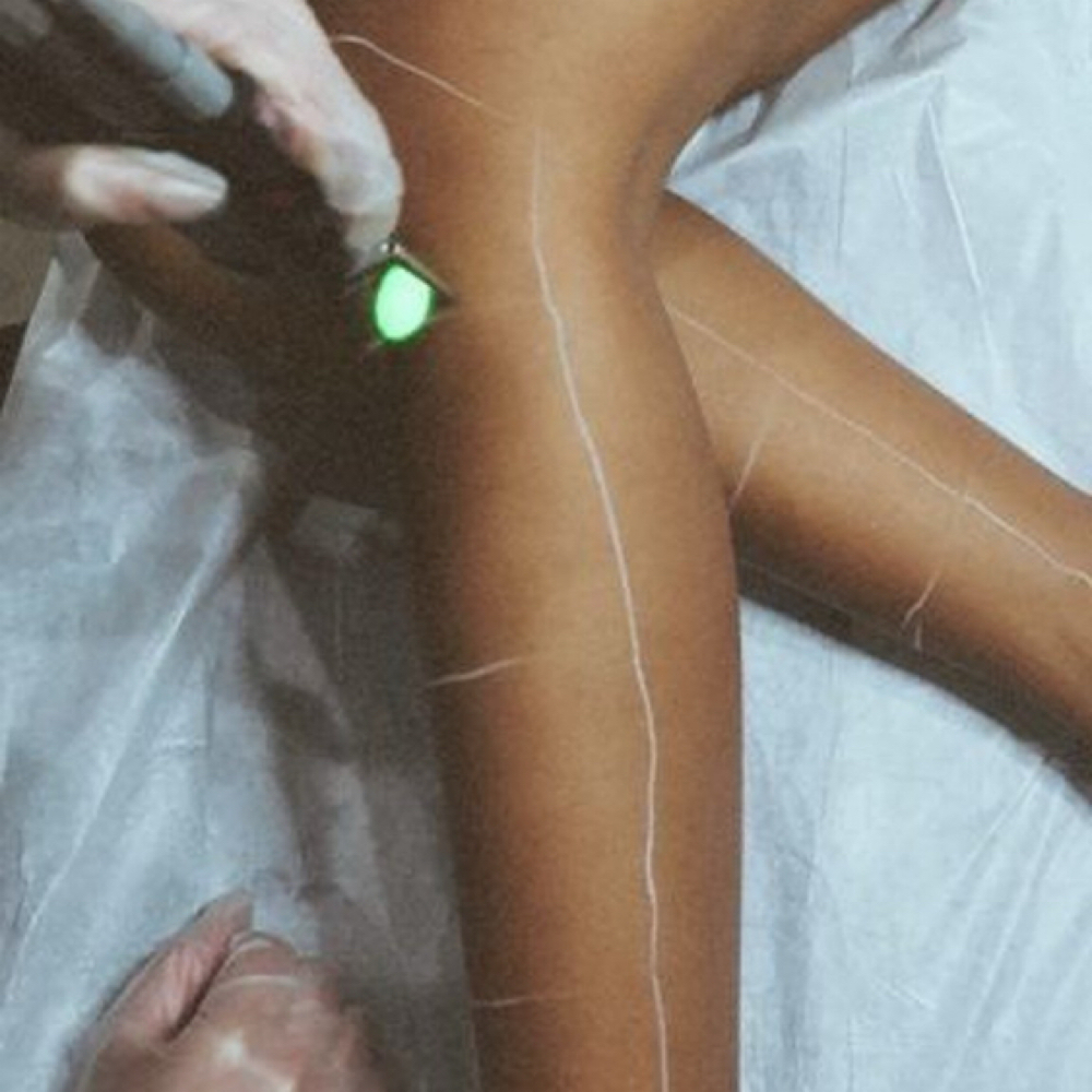 Laser Hair Removal • Knees & Below at Cox Clinic & Aesthetics in Antlers, OK