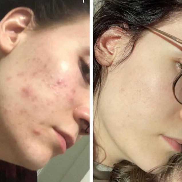 CORRECTIVE CUSTOM FACIAL