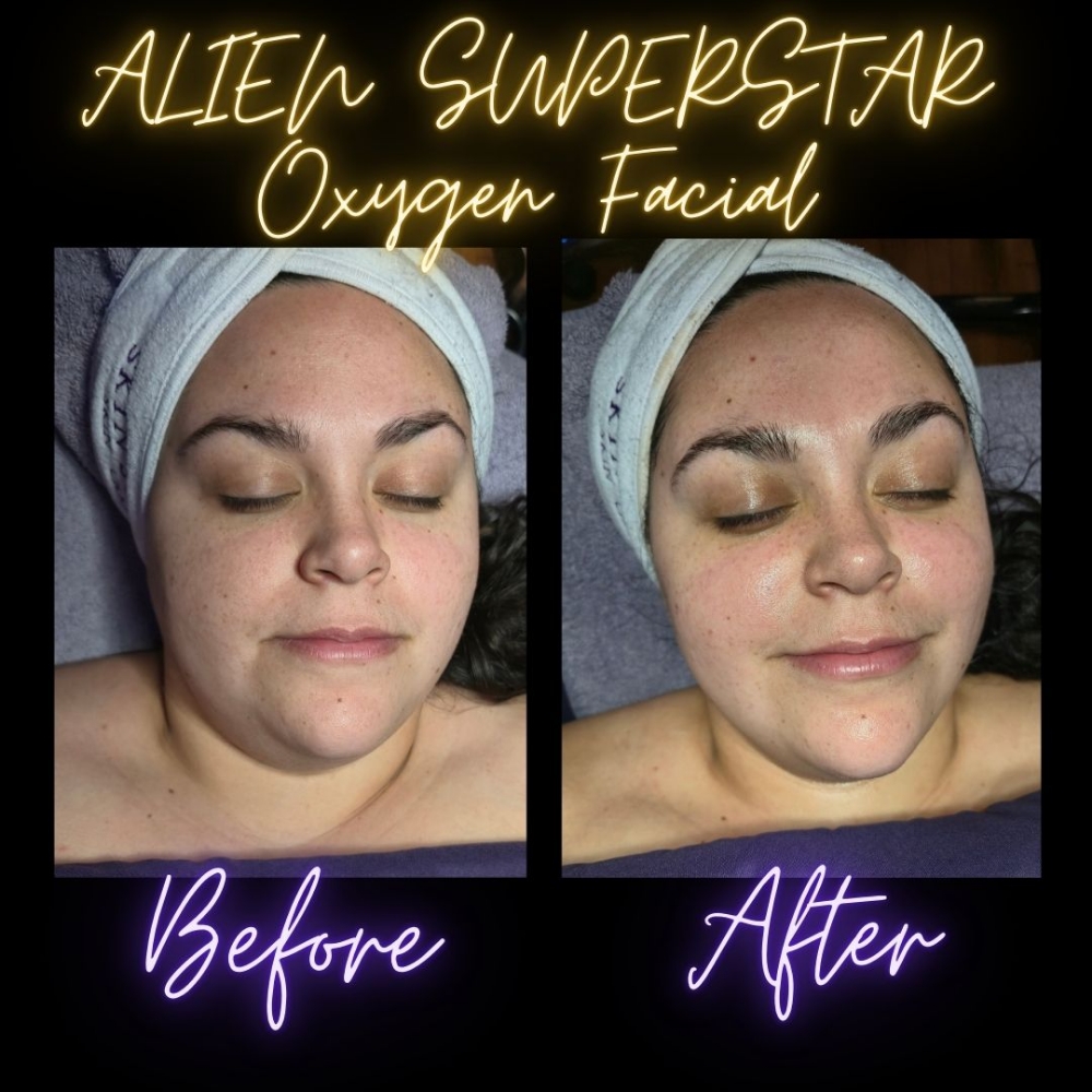 ALIEN SUPERSTAR Oxygen Facial