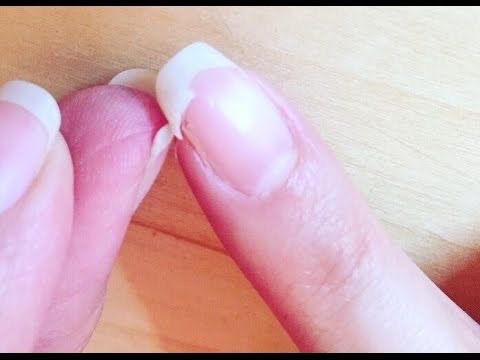 ADD ON: Nail Repair
