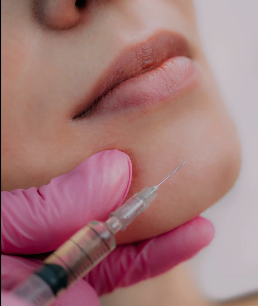 Plasma Facial/ Facial Plasma