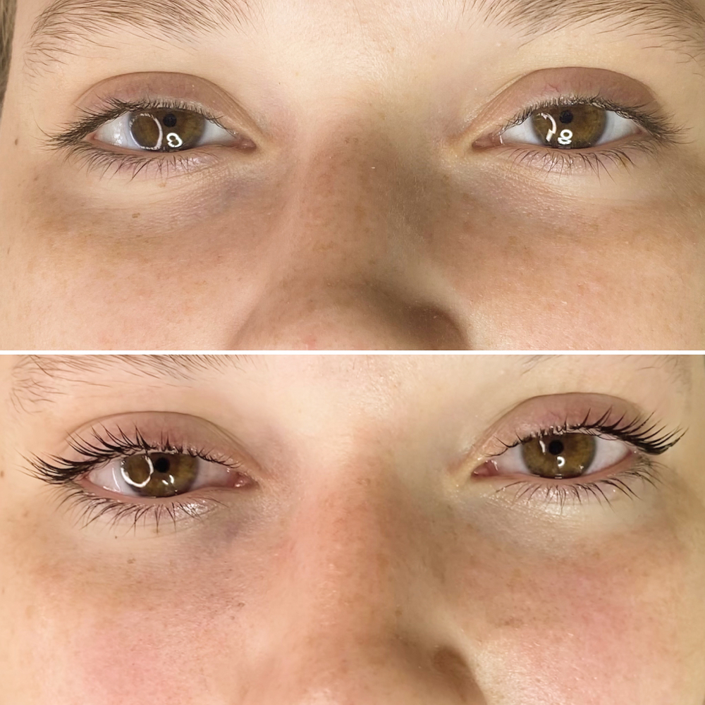 Lash Lift