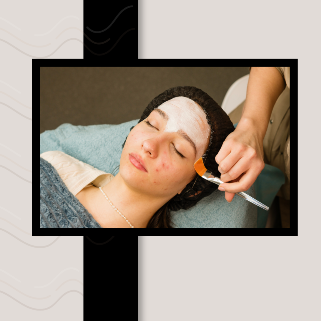 Acne Consultation + Treatment at Skin By Becca in Holly Springs, NC