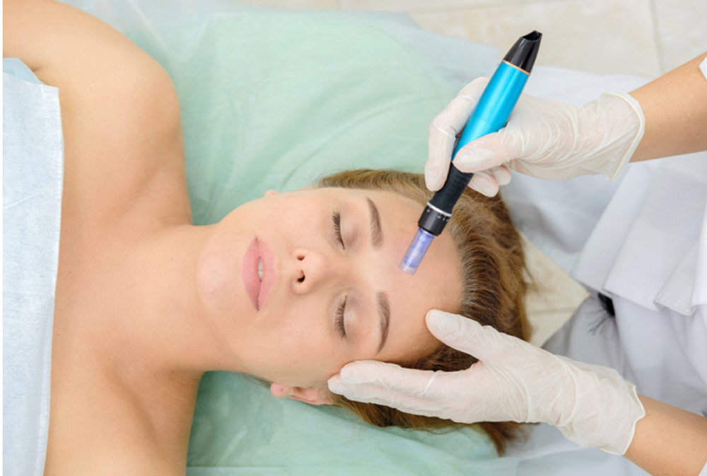 HD Microneedling Renewal