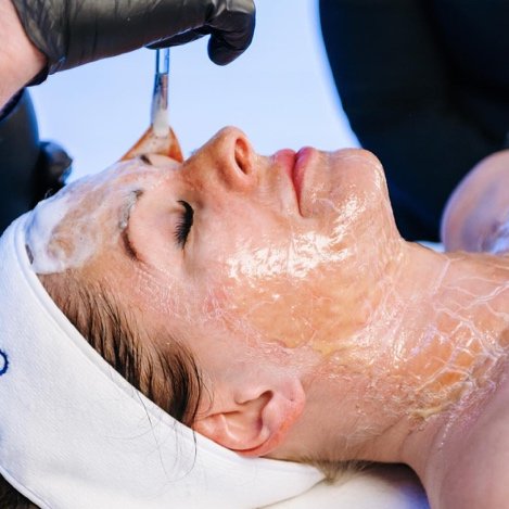 Firming Peptide Treatment