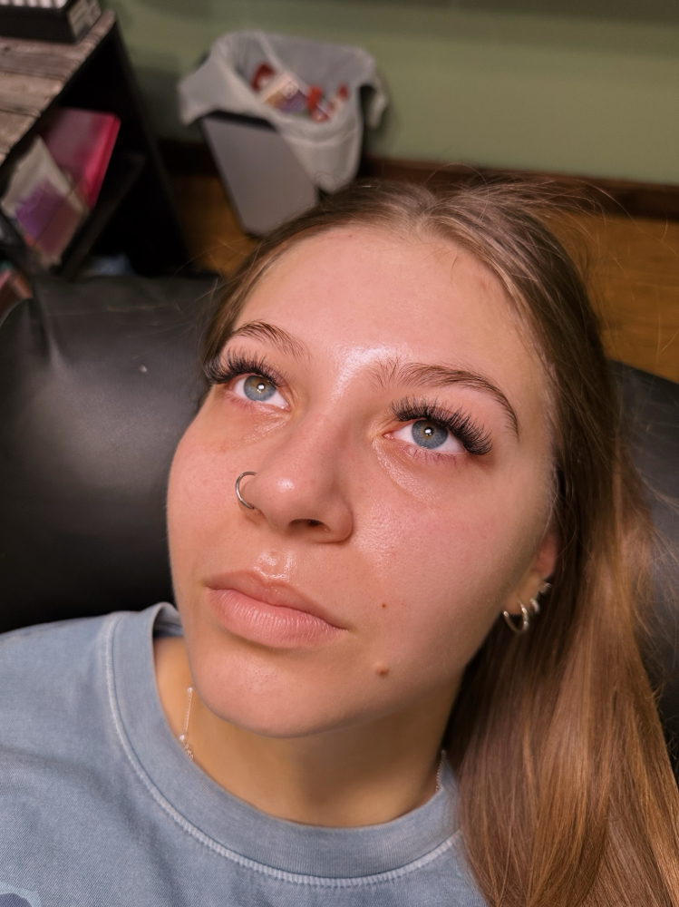 Hybrid fill