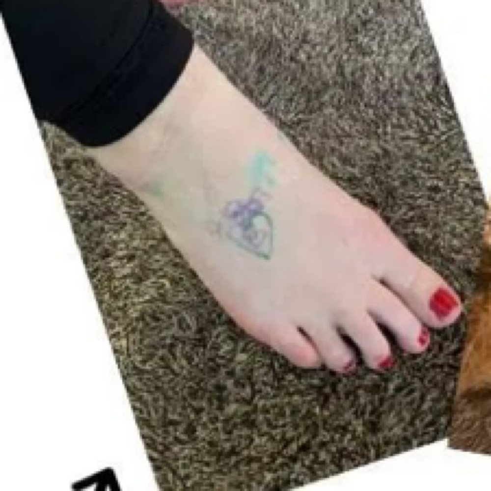 Tattoo Removal at Glo’s Beauty Creations in Lancaster, CA