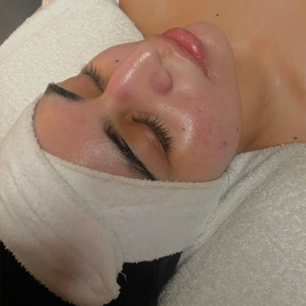 Teen Facial at Verre Skin in Pembroke Pines, FL