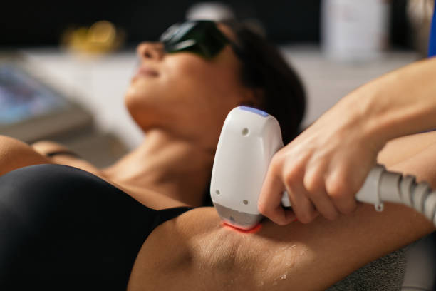 Laser Hair Removal