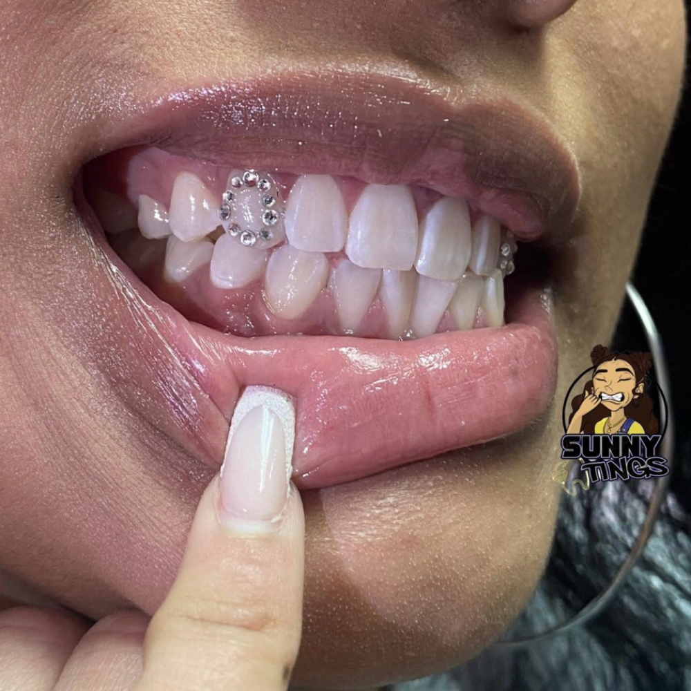 Outlined Tooth at Define Davina BEAUTY in Seattle, WA