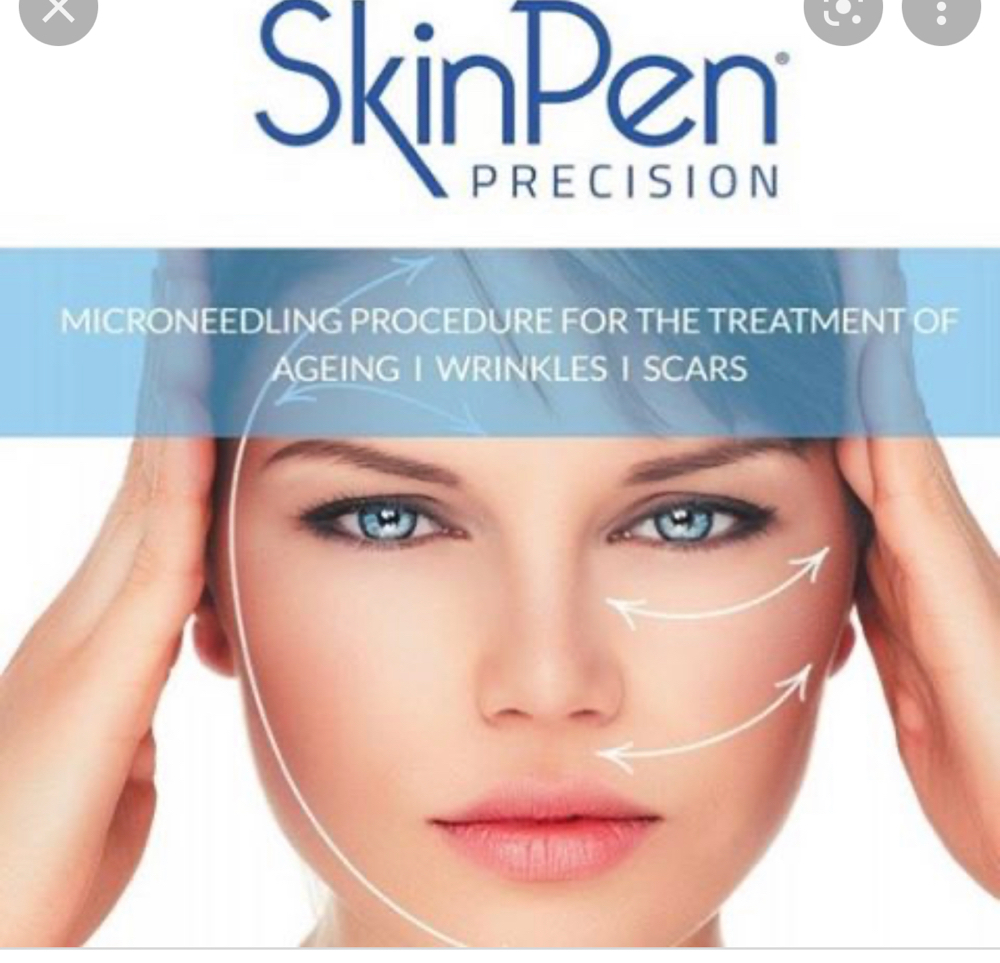 Microneedling With PRP