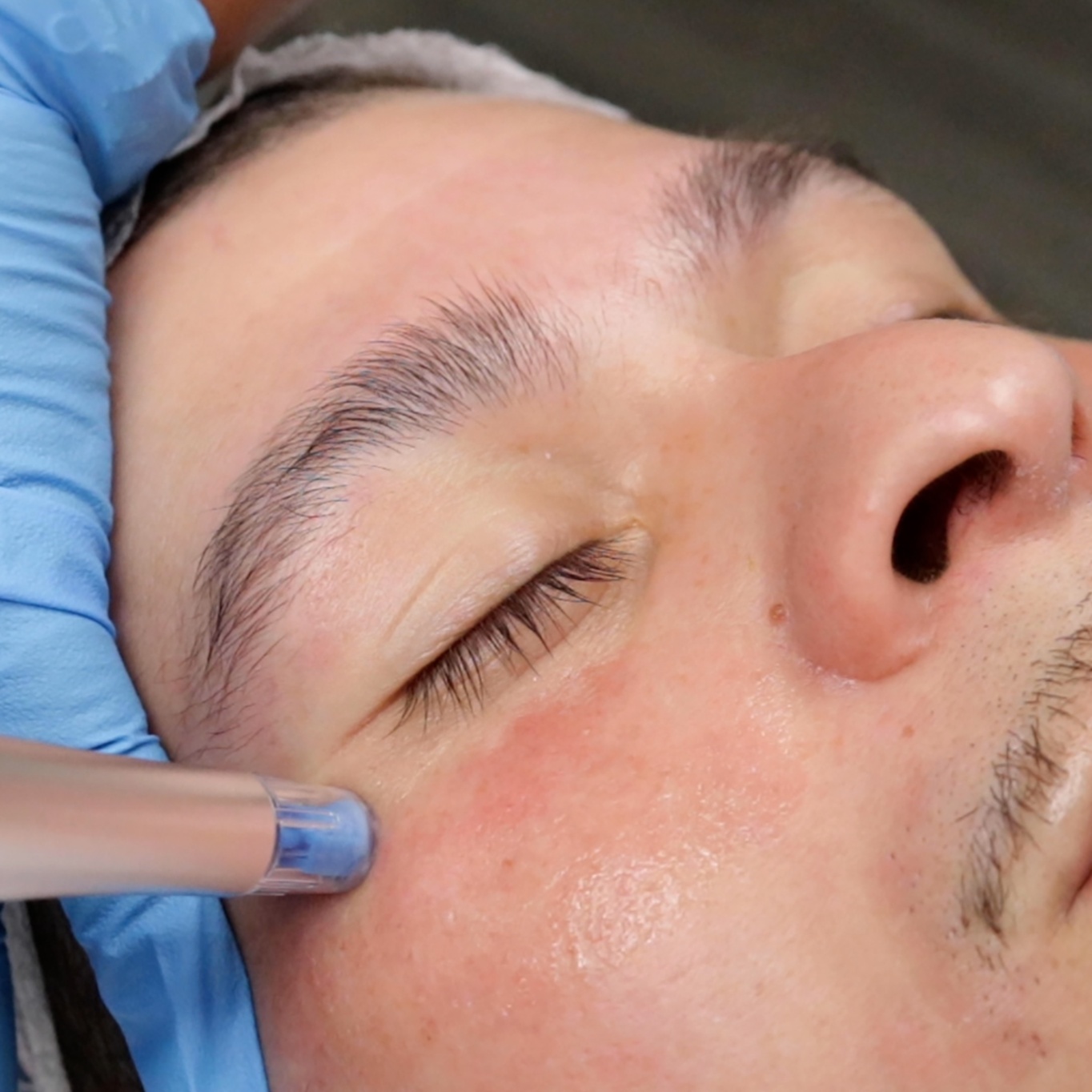 NANO Lip & Eye Renewal Add-on at SUSH Skin Studio And Spa in Covington, WA