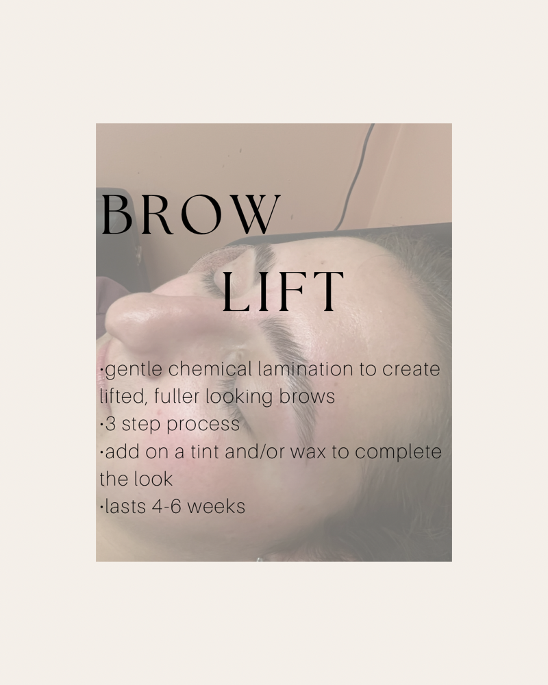 Brow Lift