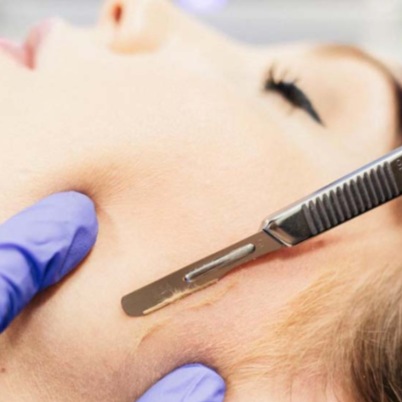 Dermaplane Facial Add-On