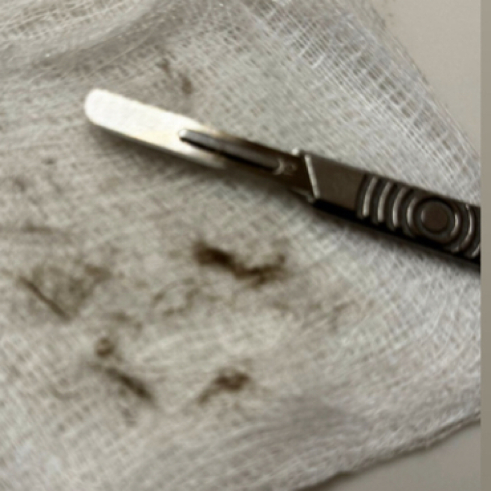 Dermaplaning Add On at Beauty Enhancer Esthetic Lounge in Franklin Square, NY