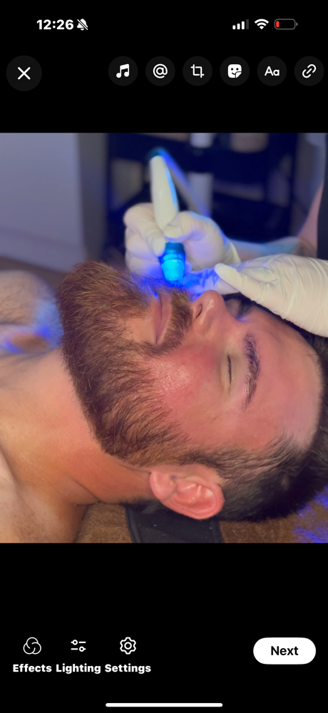 Hydrodermabrasion