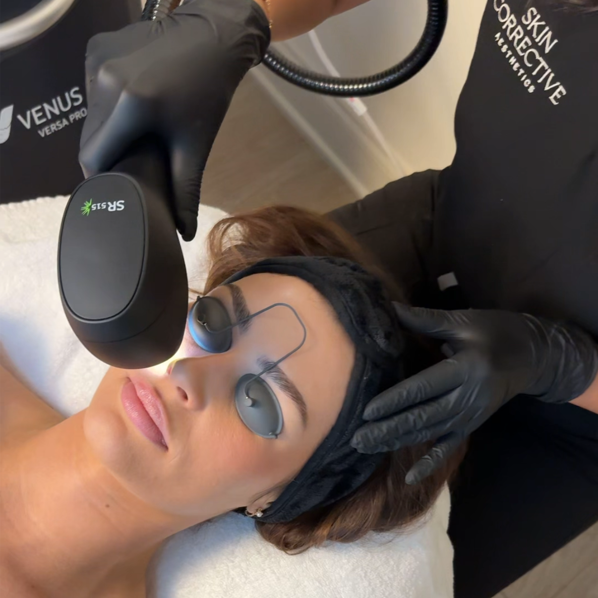 IPL Spot Treatment at Skin Corrective Aesthetics in Dallas, TX