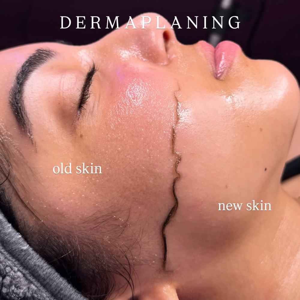 Dermaplane Facial at Blessed Beauty Aesthetics, LLC in Houston, TX