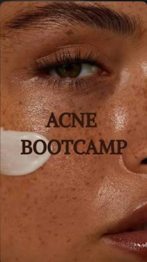Acne Bootcamp