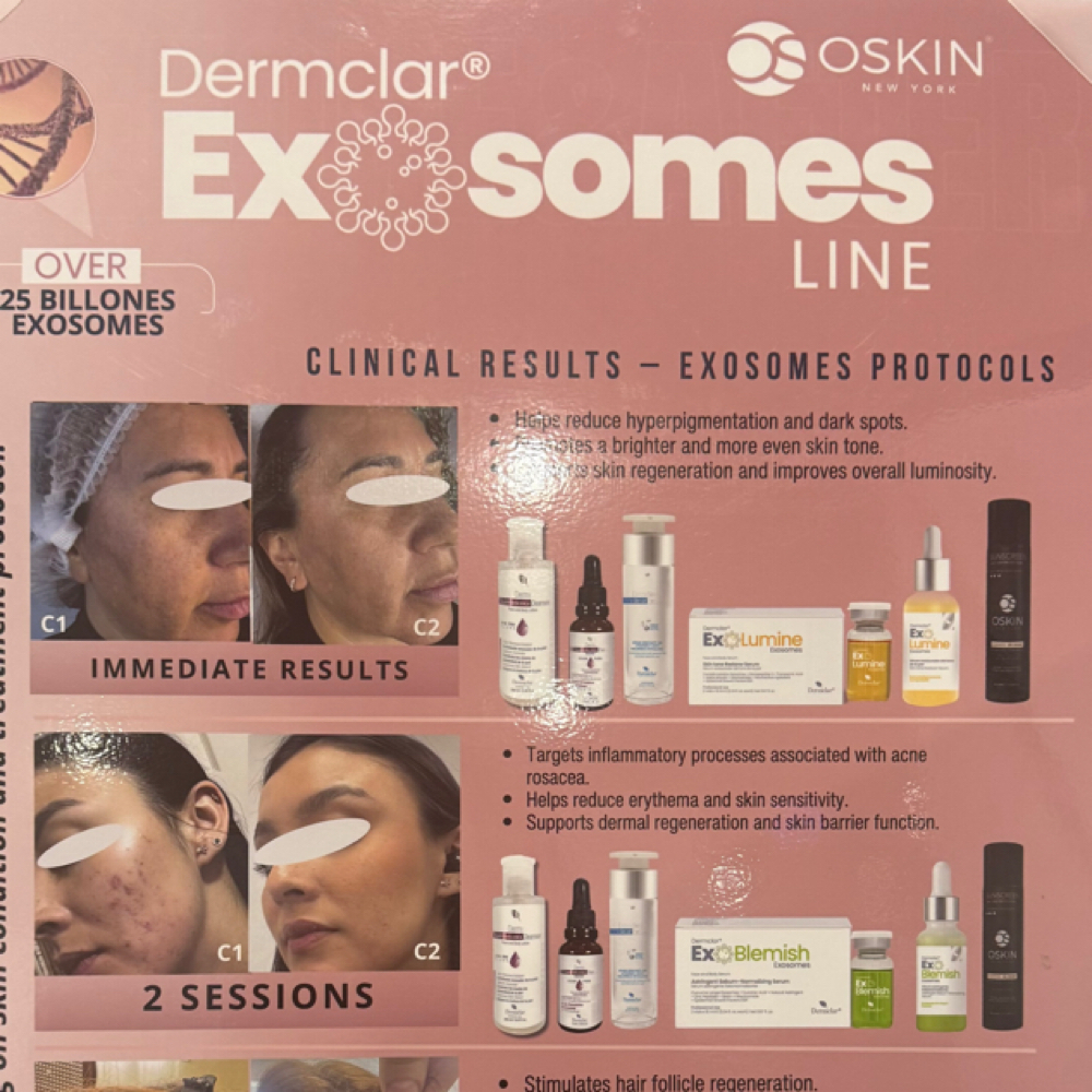 Exosome Treatment at Inner Glow Spa in College Station, TX