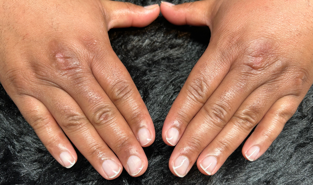 MANicure