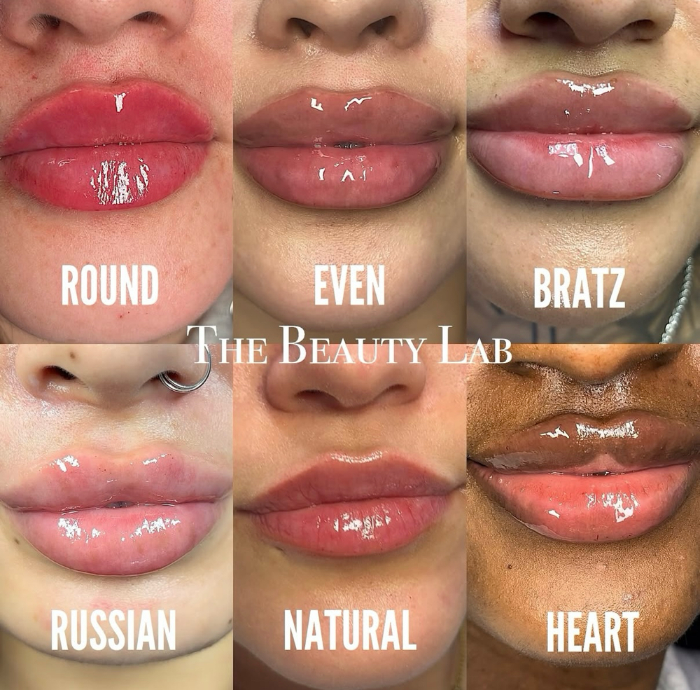 Full Syringe at The Beauty Lab DFW in Fort Worth, TX