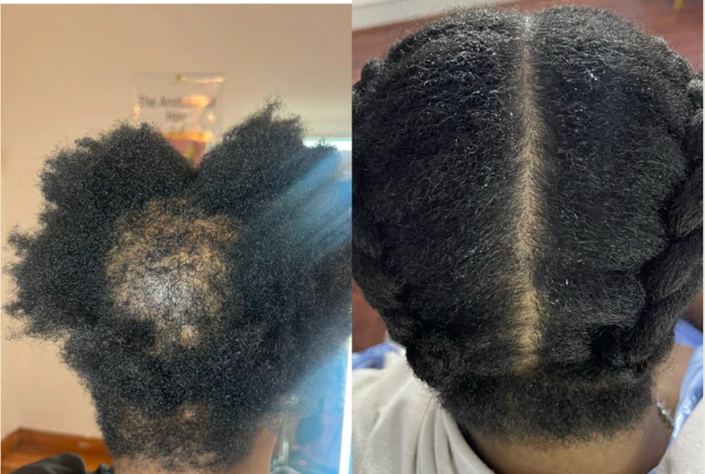 ESSENTIAL TARGETED SCALP CARE