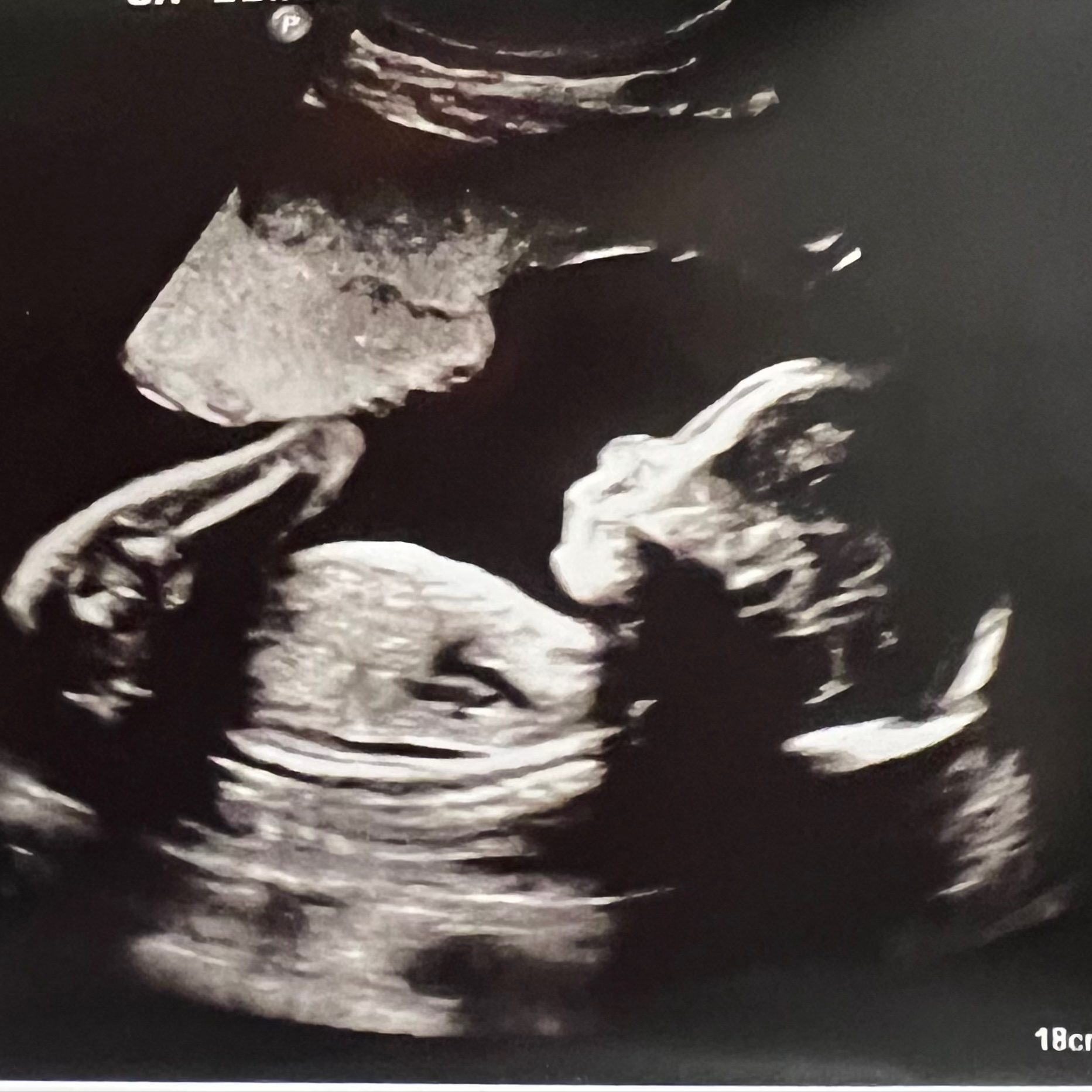 2D Preview (6-39 weeks) at Bump Studio  LLC in Rome, GA