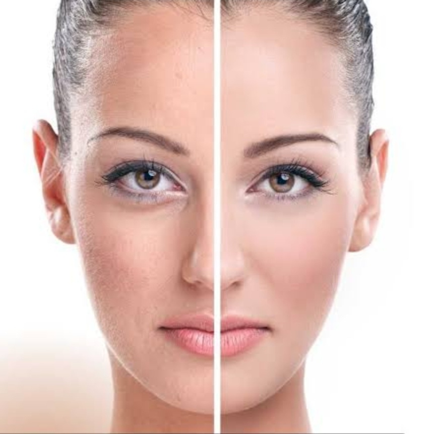 Mesotox at Skin & Toxx Medical Spa Westchase in Houston, TX