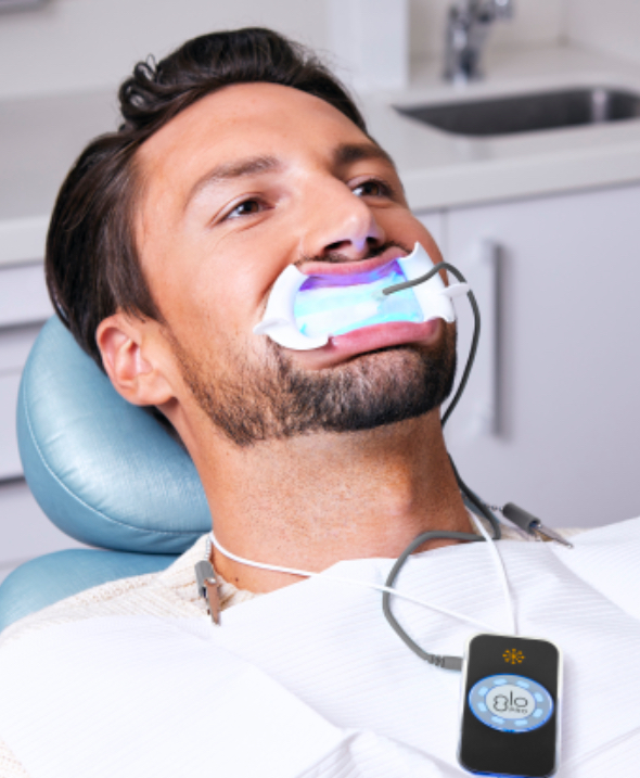 Professional Teeth Whitening