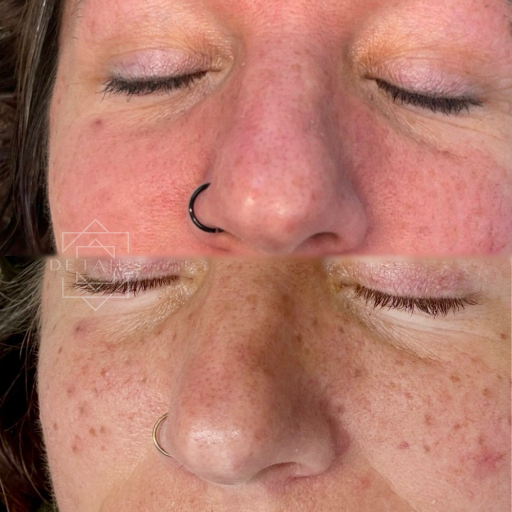 Faux Freckles +50 at Details in Lansing, MI