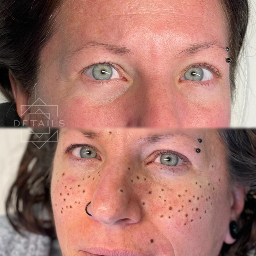 Faux Freckles +50