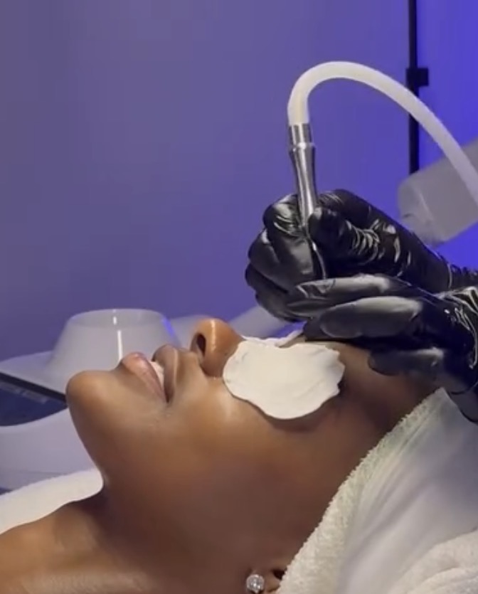 Microdermabrasion facial