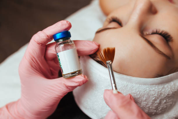 Custom Chemical Peel With Facial