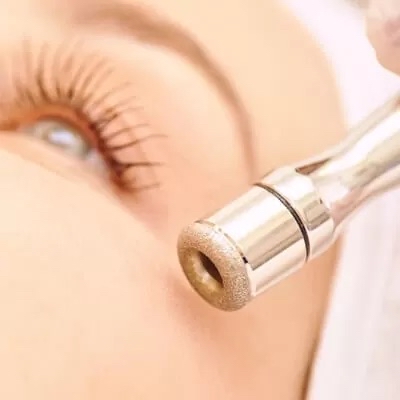 Moon Facial & Microdermabrasion